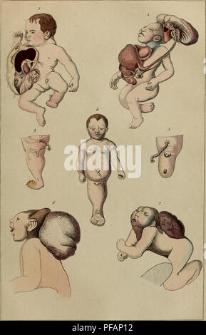 Ce dictionnaire illustré explore l’histoire naturelle et les phénomènes, en fournissant des descriptions visuelles de diverses occurrences naturelles, dont des espèces monstrueuses et rares, à travers les travaux de Félix-Edouard Guérin-Méneville. Banque D'Images
