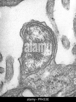 Les cellules mésothéliales péritonéale d'une souris par voie intrapéritonéale infectés expérimentalement avec Orientia tsutsugamushi micro-organismes à des rickettsies, révélé dans la microscopie électronique de transmission (TEM) de droit, 1976. Image courtoisie Centres for Disease Control (CDC) / Dr Ed Ewing. () Banque D'Images