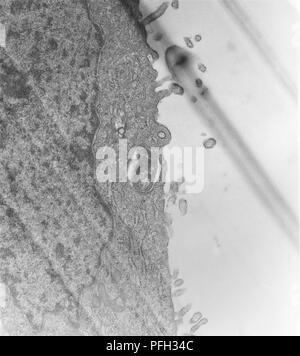 Les cellules mésothéliales péritonéales hypertrophique à partir d'une infection expérimentale de la souris par voie intrapéritonéale, Orientia tsutsugamushi micro-organismes à des rickettsies, révélé dans la microscopie électronique de transmission (TEM) de droit, 1976. Image courtoisie Centres for Disease Control (CDC) / Dr Ed Ewing. () Banque D'Images