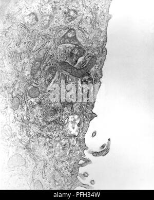 Les cellules mésothéliales péritonéales hypertrophique à partir d'une infection expérimentale de la souris par voie intrapéritonéale, Orientia tsutsugamushi micro-organismes à des rickettsies, révélé dans la microscopie électronique de transmission (TEM) de droit, 1976. Image courtoisie Centres for Disease Control (CDC) / Dr Ed Ewing. () Banque D'Images