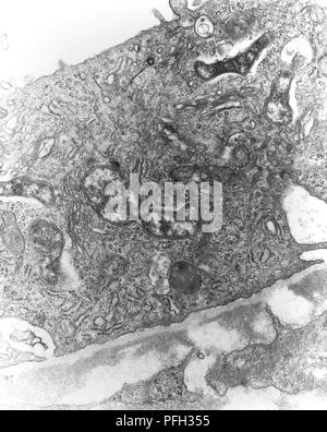 Les cellules mésothéliales péritonéales hypertrophique de souris infectés expérimentalement par voie intraveineuse avec Orientia tsutsugamushi micro-organismes à des rickettsies, révélé dans la microscopie électronique de transmission (TEM) de droit, 1976. Image courtoisie Centres for Disease Control (CDC) / Dr Ed Ewing. () Banque D'Images