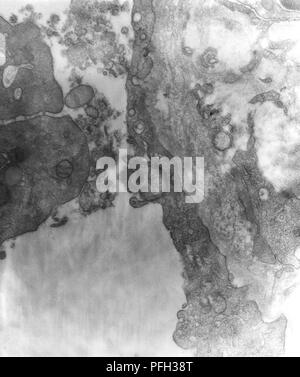 Les cellules mésothéliales péritonéale d'une souris par voie intrapéritonéale infectés expérimentalement avec Orientia tsutsugamushi micro-organismes à des rickettsies, révélé dans la microscopie électronique de transmission (TEM) de droit, 1976. Image courtoisie Centres for Disease Control (CDC) / Dr Ed Ewing. () Banque D'Images