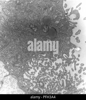Les cellules mésothéliales péritonéales hypertrophique de souris infectées expérimentalement par voie intrapéritonéale, Orientia tsutsugamushi micro-organismes à des rickettsies, révélé dans la microscopie électronique de transmission (TEM) de droit, 1976. Image courtoisie Centres for Disease Control (CDC) / Dr Ed Ewing. () Banque D'Images