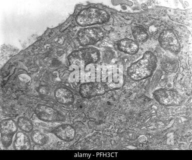Les cellules mésothéliales péritonéales hypertrophique de souris infectées expérimentalement par voie intrapéritonéale, Orientia tsutsugamushi micro-organismes à des rickettsies, révélé dans la microscopie électronique de transmission (TEM) de droit, 1976. Image courtoisie Centres for Disease Control (CDC) / Dr Ed Ewing. () Banque D'Images