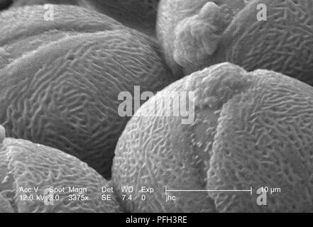 L'ultrastructure morphologiques des grains de pollen trouvés sur un 'jaune' artifice sundrops, Oenothera fruticosa fleur, révélé dans le 3375x amplifiés en microscopie électronique à balayage (MEB) de droit, 2006. Image courtoisie Centres for Disease Control (CDC) / Janice Haney Carr, Betsy grue. () Banque D'Images