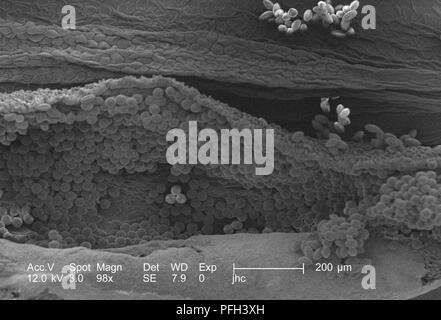 Les granules de pollen d'ultrastructure morphologique trouvé sur une 'jaune' artifice sundrops, Oenothera fruticosa fleur, révélé dans le 98x amplifiés en microscopie électronique à balayage (MEB) de droit, 2006. Image courtoisie Centres for Disease Control (CDC) / Janice Haney Carr, Betsy grue. () Banque D'Images