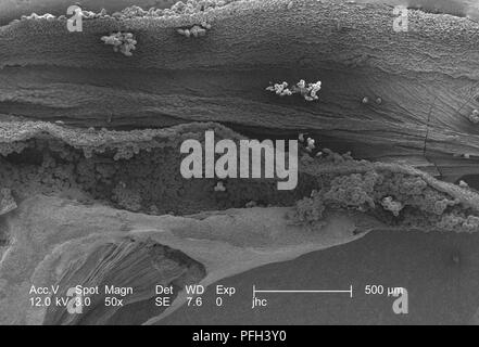 Les granules de pollen d'ultrastructure morphologique trouvé sur une 'jaune' artifice sundrops, Oenothera fruticosa fleur, révélé dans les années 50 x amplifiés en microscopie électronique à balayage (MEB) de droit, 2006. Image courtoisie Centres for Disease Control (CDC) / Janice Haney Carr, Betsy grue. () Banque D'Images