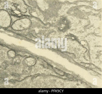 . La cytologie. La cytologie. La figure 4-6. Micrographe de partie de la fin de la prophase ; noyau dans une cellule de cortex externe de l'extrémité de la racine de l'oignon. Trois secteurs de l'enveloppe nucléaire sont visibles, dont l'un conserve toujours une connexion avec un élément de la membrane du réticulum endoplasmique. En dehors des vestiges de l'enveloppe nucléaire et d'encercler le noyau est une zone à partir de laquelle les mitochondries et les plastes sont exclus. Grandes vésicules avec une membrane limitante et homo- solutions content, appelé phragmosomes, commencent à apparaître avec l'augmentation de la fré- quence à cette étape de la division cellulaire. (À partir de la Porter, K. Banque D'Images