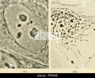 . La cytologie. La cytologie. tiges, ou des filets qui varient en taille, nombre, et la distribution d'une cellule à l'autre (Figure 3-2 (a) et (b) ). Ils sont plus facilement identifiés dans la cellule vivante par leur affinité pour les colorants vitaux. Vert Janus. En taille, ils vont d'objets allongés de plusieurs micra en longueur jusqu'à la limite de la résolution du microscope photonique. Lorsque les sections individuelles à travers les mitochondries sont considérées avec le microscope électronique, un modèle général. Figure 3-2. Phase-Contrast photomicrographies de mitochondries dans les cellules vivantes à partir de la Culture de (a) foetus rein, et (b) Salamander Coeur. ( Banque D'Images