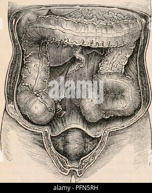 . La cyclopaedia d'anatomie et physiologie. Anatomie ; physiologie ; Zoologie. 362 estomac et l'intestin. ce qui ressemble à celui des cellules tapissant les branches plus petites de la ligne droite des tubules. Où les petits tubes convergent pour former le conduit efférent qui perfore la membrane muqueuse, ces cellules sont échangés pour les bouteilles courtes dont la structure rapidement se fond dans celui de l'ordinaire de l'épithélium cylindrique surface intestinale. En ce qui concerne l'accrétion de ces glandes racémeuses, nous pouvons cependant affirmer que leurs gaines contiennent un mucus sans structure, qui a une réaction alcaline Banque D'Images