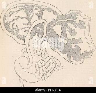 . La cyclopaedia d'anatomie et physiologie. Anatomie ; physiologie ; Zoologie. 98 PANCRÉAS. La sécrétion pancréatique est le premier versé dans les intestins, et la fibrose biliaire, la dernière : et toujours quand il y a trois canaux pancréatiques, la sécrétion atteint l'intestin au début par l'un d'eux, et les autres ont leur upenings à proximité de la voie biliaire, soit avant ou entre eux. Il n'est pas sûr, cependant, de tirer des conclusions de ces physiologiques positions relatives, à supposer même qu'elles soient constamment ; pour les gaines sont si près l'un de l'autre, que le mélange des fluides doivent avoir lieu Banque D'Images