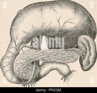 . La cyclopaedia d'anatomie et physiologie. Anatomie ; physiologie ; Zoologie. 82 PANCRÉAS. entièrement disséqué, il présente les cardinaux par exemple, le sillon longitudinal occupé et dépressions correspondant à eux, comme, par la veine splénique et gorge profonde à la Fig. 51.. Les pancréas, sliou-n in situ par vomir le suliject où la courbure de la tête du puits particulièrement illustré. qui l'artère mésentérique supérieure et la veine portae sont reçus. En face c'est en rapport avec la face postérieure de l'estomac, qui repose sur elle à vide (tanquam pulvinar, Scemm.), et Banque D'Images