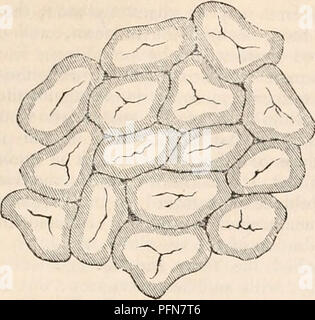 . La cyclopaedia d'anatomie et physiologie. Anatomie ; physiologie ; Zoologie. Anatomie ANORMALE DU FOIE. Fig. 44.. Les lobules dans un état de congestion veineuse portale, comme vu sur la surface de la foie. La partie congestionnée oc- cupies les marges des lobules, la partie sans encombrement leurs centres. Après Kiernan. dullary et occupant les centres des lo- bules." Les causes de la congestion sont tous comme ont tendance à nuire à la circulation dans le foie ou avec la circulation générale ; par exemple, obstacle à la circulation du sang dans les capillaires des poumons, disea Banque D'Images