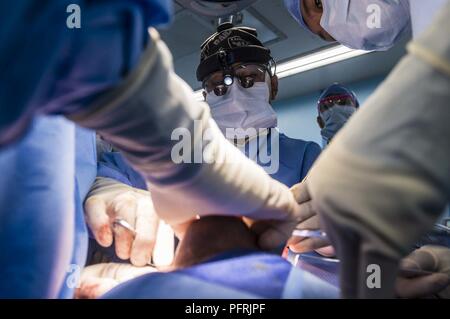 TRANG, Vietnam (30 mai 2018) - Le Lieutenant Cmdr. Art Ambrosio, actuellement affectés à la commande de transport maritime militaire navire-hôpital USNS Mercy (T-AH-19), des extraits de la messe d'un patient pendant une chirurgie du cerveau avec des chirurgiens vietnamiens à l'appui de Partenariat du Pacifique 2018 (PP18). PP18's mission est de travailler ensemble avec l'hôte et les pays partenaires à améliorer l'interopérabilité régionale et de capacités de réaction aux catastrophes, l'augmentation de la stabilité et la sécurité dans la région, et de favoriser de nouvelles amitiés et durable dans toute la région Indo-Pacifique. Partenariat du Pacifique, maintenant dans sa 13e version, est la plus grande rencontre annuelle multi Banque D'Images