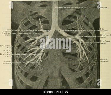 . Cunningham's Text-book de l'anatomie. L'anatomie. 1082 LE EESPIKATOEY SYSTÈME. La muqueuse est mis facilement sur l'intérieur du tube sur une couche de tissu aréolaire sous-muqueux. Les tissus lymphatiques passe en grande partie dans la composition de la muqueuse trachéale, et sa surface intérieure est bordée de colonnes de cellules épithéliales ciliées. L'action des cils exerce une influence importante dans la création d'un mouvement ascendant du mucus qui est présent sur la surface de la muqueuse. De nombreux faisceaux longitudinaux de tissu élastique sont présents dans la paroi dorsale de la trachée, plus part Banque D'Images