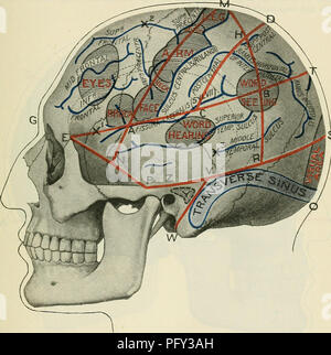 . Cunningham's Text-book de l'anatomie. L'anatomie. Le CEANIUM. 1361 suivi d'une paralysie de la main, mais l'utilisation et la puissance de la main est repris dans quelques semaines, ablations, d'autre part, de même une grande partie de la convolution centrale postérieure ne donnent pas lieu à une paralysie transitoire même. Dans certaines des expériences sur animaux, le moteur a été trouvé à s'étendre à la partie plus profonde de la paroi postérieure du sillon central d'Eolando. En avant elle s'étendait dans le centre de sillons ainsi que dans les sillons occasionnels qui traversent le gyrus pré-central ; en fait la partie cachée Banque D'Images