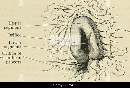 . Cunningham's Text-book de l'anatomie. L'anatomie. L'intérieur du caecum correspond en général à l'apparence que du gros intestin ; mais elle présente deux particularités sur la partie postérieure de sa paroi interne, à savoir, l'orifice iléo-csecal, gardé par la valvula coli (O.T ileo caecale-"), et au-dessous de ce la petite ouverture du processus vermiformis, les deux faisant appel à d'autres avis. Valvula Ooli (O.T. Ileo-csecal).-où l'iléon entre dans le gros intestin, l'extrémité du petit intestin est, pour ainsi dire, poussée par la paroi du gros intestin, entraînant avec lui certains l Banque D'Images