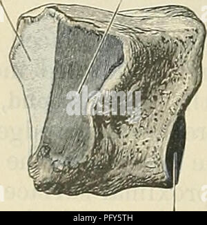 . Cunningham's Text-book de l'anatomie. L'anatomie. II. Métatarse Fig. 265.-Le droit deuxième écriture cunéiforme (face interne).. Veuillez noter que ces images sont extraites de la page numérisée des images qui peuvent avoir été retouchées numériquement pour plus de lisibilité - coloration et l'aspect de ces illustrations ne peut pas parfaitement ressembler à l'œuvre originale.. Cunningham, D. J. (Daniel Jean), 1850-1909 ; Robinson, Arthur, b. 1862, éd. New York, W. Wood Banque D'Images