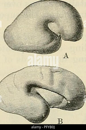 . Cunningham's Text-book de l'anatomie. L'anatomie. L'ESPACE ACOUSTIQUE ET FIBEE-TEACTS. Dans l'embryon du cinquième mois (Fig. 583, B), ainsi que dans chaque étape ultérieure, même jusqu'à l'état adultes (Fig. 582), une zone sur la surface supérieure de l'opercule temporelle peut être vu à la pente vers le dedans vers le membre supérieur du sillon circularis, derrière l'insula. Cette zone constitue le centre d'impressions acoustiques réceptif-gyrus la temporalis transversus ou Heschl convolution du -même si l'ampleur de cette zone acoustico-sensorielle ne coïncide pas exactement avec celle de l'apophyse transverse tempo Banque D'Images