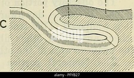 . Cunningham's Text-book de l'anatomie. L'anatomie. Fig. 575.-des diagrammes pour expliquer trois types d'Furrotvs cérébral. Le pôle frontal, tandis que la partie saillante de l'extrémité postérieure est appelé le pôle occipital. Sur la face inférieure de l'hémisphère cérébral le point de vue qui s'étend vers l'alcoolisme et au-dessous de la scissure latérale reçoit le nom du pôle. Dans un cerveau trempé une encoche large est généralement présente sur la face interne et inférieure, aspect de la pole occipital de l'hémisphère droit. Cela correspond à l'ouverture de la sinus veineux transverse droit. Un Banque D'Images