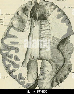 . Cunningham's Text-book de l'anatomie. L'anatomie. Le CEEEBEAL COMMISSIVES ET SEPTUM PELLUCIDUM. 631 tissus avec de la lamina terniinalis sur l'abord antéro-supérieur aspect de la commissure antérieure (Fig. 558). La face inférieure du corps calleux sur chaque côté du plan médian est enduit de l'épendyme (Fig. 564, p. 635), et forme le toit de la corne antérieure et le corps du ventricule latéral. Dans le plan médian, cependant, c'est joint à des pièces sous-jacentes, à savoir le septum pellucidum en face et directement ou indirectement (Fig. 564) pour le corps du fornix derrière (Fig. 558, p. 630). Le tr Banque D'Images