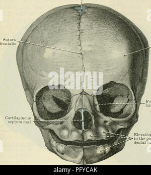 . Cunningham's Text-book de l'anatomie. L'anatomie. Le crâne À BIETH. 195 signification morphologique, et ne sont pas plus facilement l'origine de l'hypothèse qu'ils sont de simples irrégularités dans l'ossification de l'occlusion de la membrane. L'fonticulus sagittale est parfois vu dans le crâne à la naissance comme une fissuration transversale ou angulaire ; fente sagittale encocher le marge de l'os pariétal, perpendiculairement à la ligne de la suture sagittale, et en correspondance avec la position de la débredinoire pariétal, les marges de ce qui peut encore être sternèbre et formé par la membran Banque D'Images