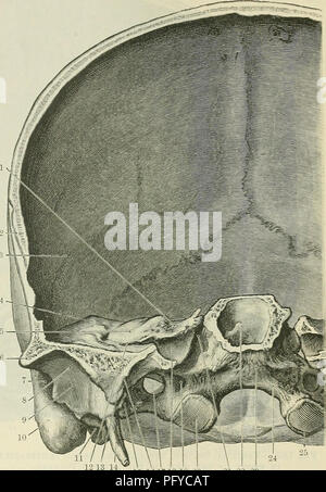 . Cunningham's Text-book de l'anatomie. L'anatomie. CEANIUM FKONTAL ARTICLES DE LA. 191 La figure suivante (Fig. 179) affiche la surface antérieure de l'article juste derrière que décrit ci-dessus. Dans le centre est considéré le corps du sphenoid, et la paroi postérieure du sinus est maintenant exposée ; d'un côté ou de l'apex de la partie petrous de la contiguïté temporelle sur le côté du corps du sphenoid, et le grand orifice de la canal carotidien est vu ouvrant sur la paroi postérieure du foramen lacerum, qui est ici divisé. Dans le renfoncement situé entre la paroi latérale du canal carotidien et Banque D'Images