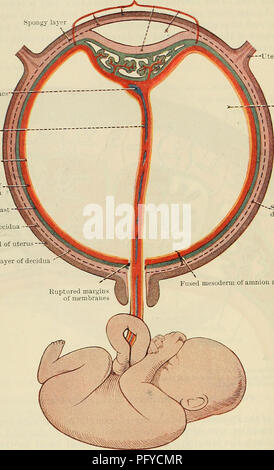 . Cunningham's Text-book de l'anatomie. L'anatomie. L'embryologie humaine 62 plaque de fermeture du chorion espaces intervilleux interne ; (2) les villosités ; (3) les espaces intervilleux ; et (4) la couche basale du trophoblaste, qui ferme l'Espace intervilleux extérieurement, et est perforé par les navires passant à la mère et de l'espaces. La partie maternelle du placenta est composé de l'intérieur vers l'extérieur de (1) la couche basale de la caduque ; (2) le reste de la couche spongieuse de la caduque ; et (3) la même couche. Lay spongieux sacs vitellins cordon ombilical de l'ectoderme amnios Fused mesode Banque D'Images