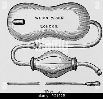 . Obstétrique vétérinaire ; un recueil à l'usage des étudiants et des praticiens. Obstétrique vétérinaire. q8 obstétrique vétérinaire. être ajouté sédatifs ou anodynes, comme teinture d'opium, teinture ou extrait fluide de belladonna, ou l'hydrate de chloral. Pour l'étranglement appliquer des parties égales d'extrait solide, de belladone et de la vaseline. Gérer en interne le chloroforme, teinture d'opium, ou le chloral, et garder l'animal le plus calme possible. Ces défaut, essayer de dilater- le système d'exploitation en vigueur, que par l'introduction des doigts, qui peut parfois aboutir à la relaxation. Une autre méthode est par l'insertion d'un endroit sec Banque D'Images