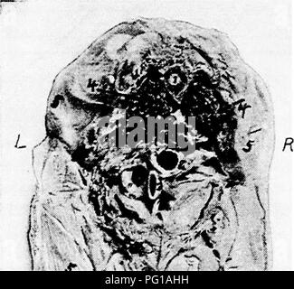 . L'anatomie de la poule domestique . Les animaux domestiques ; médecine vétérinaire ; la volaille. L'anatomie ou la8 EST AUX OISEAUX de communications vasculaires et nerveuses avec l'orgue qui lui est attaché. La partie libre de l'intestin grêle est jointe à la marge du mésentère. Les RELATIONS DE L'organes viscéraux de la volaille domestique La figure 33 montre un oiseau avec le côté gauche de l'abdomen et la paroi thoracique gauche retiré. N° i en cette figure montre la base de la. -Z v*.--. Fig. 40.-transversale à travers le corps d'une poule à 14, fig. 34. R, côté droit. L, côté gauche, j'ai, de la moelle épinière. 2, l'Eso Banque D'Images