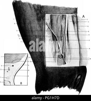. L'Anatomie chirurgicale du cheval ... Les chevaux. XXVI la plaque.-A.-Siège de Neurectomie tibial postérieur disséqués. I. muscle Popliteus. 2. La peau et les couches superficielles et profondes du fascia reflétée. 3. t'accessorius lexor. 4. Tendon du fléchisseur perforatus. 5. Racine postérieure de la veine saphène interne. 6. Tendon du muscle gastrocnémien. 7. Flexor perforans. 8. Nerf tibial postérieur. 9. Fascia profond. 10. L'artère tibiale postérieure. II. Fascia superficiel. 12. La direction de cutanées 13 tibial postérieur. Flexion sigmoïde de l'artère tibiale postérieure I. Flexor perforans. 2. Flexor accessorius. avec venae comites. 6. Superfic Banque D'Images