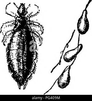 . La biologie élémentaire, animale et humaine. La biologie. Fig. 43.-San José les cochenilles sur la poire. Ci-dessus, seule échelle élargie. (Howard) A B la FiQ. 44. - A, B, des œufs de poux ; au- tached aux cheveux.. Veuillez noter que ces images sont extraites de la page numérisée des images qui peuvent avoir été retouchées numériquement pour plus de lisibilité - coloration et l'aspect de ces illustrations ne peut pas parfaitement ressembler à l'œuvre originale.. Peabody, James Edward, b. 1869 ; Hunt, Arthur Ellsworth, coauteur. New York, The Macmillan Company Banque D'Images