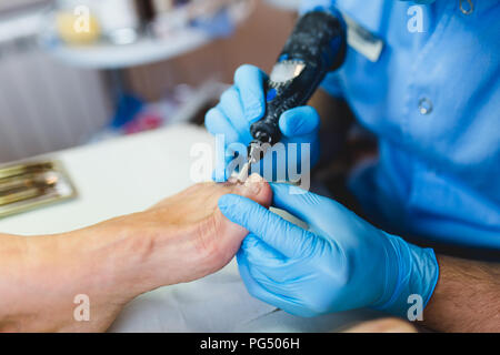 Le mycète d'un traitement par laser à pied ongle laser therapy clinic. Banque D'Images