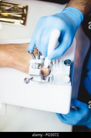 Le mycète d'un traitement par laser à pied ongle laser therapy clinic. Banque D'Images