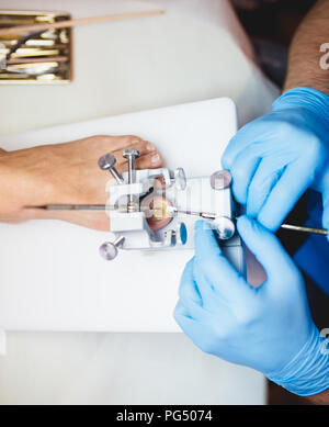 Le mycète d'un traitement par laser à pied ongle laser therapy clinic. Banque D'Images