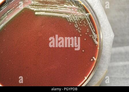 Morphologie des colonies de bactéries Gram-négatif Francisella tularensis bactéries croissant 48 heures sur un support de la cystéine coeur agar, 2010. Image courtoisie Centres for Disease Control (CDC) / Dr Todd Parker, Audra Marsh. () Banque D'Images