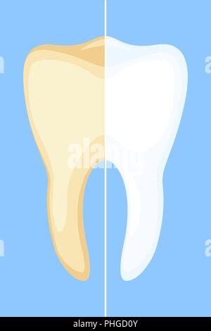 Concept de blanchiment des dents. Illustration de Vecteur