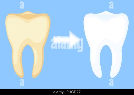 Concept de blanchiment des dents avant et après. Illustration de Vecteur