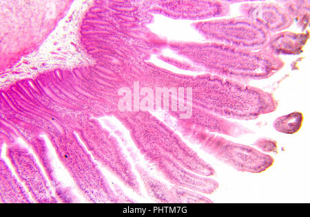 Photographie en microscopie électronique. La section transversale de l'intestin grêle. Banque D'Images