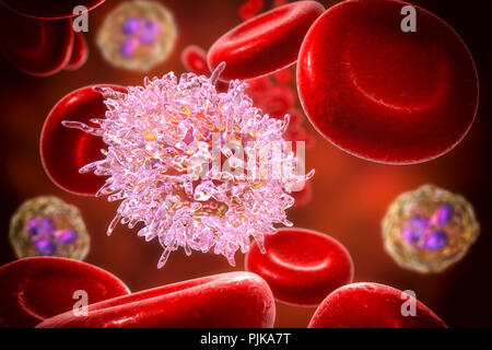 La leucémie à tricholeucocytes. Illustration d'ordinateur d'anomalies des globules blancs (lymphocytes B-) d'un patient atteint de leucémie à tricholeucocytes. Ces cellules présentent des projections cytoplasmiques des cheveux et des volants sur leurs surfaces. La leucémie est un cancer du sang dans lequel le sang des tissus de production dans la moelle osseuse produit un nombre excessif de globules blancs immatures, comme on le voit ici, qui nuisent à la fonction des cellules sanguines normales. Le système immunitaire est donc affaiblie. La leucémie à tricholeucocytes est une forme rare de leucémie qui affecte principalement les hommes. La plupart des patients survivent pendant cinq ans ou plus après le diagnostic. Banque D'Images