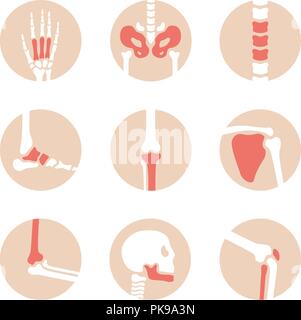 Vector set des articulations avec les pièces endommagées. La maladie dans l'os, genou, jambe, bassin, de l'omoplate, du crâne, du coude, du pied et de la main l'illustration. L'arthrite et le rhumatisme des icônes sur fond blanc Illustration de Vecteur