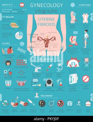 Les fibromes utérins. Ginecological maladie médicale chez les femmes infographie. Vector illustration Illustration de Vecteur