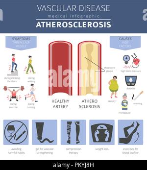 Les maladies vasculaires. L'athérosclérose symptômes, traitement icon set. Conception infographique médical. Vector illustration Illustration de Vecteur