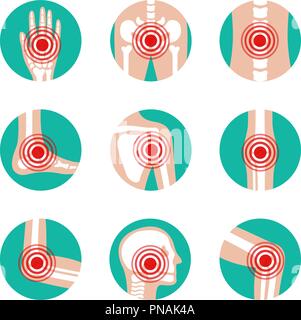 Vector set de joints avec des joints toriques de la douleur. La maladie dans l'os, genou, jambe, bassin, de l'omoplate, du crâne, du coude, du pied et de la main l'illustration. L'arthrite et le rhumatisme des icônes. Illustration de Vecteur