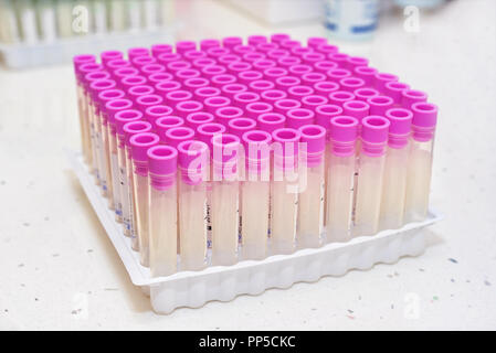 Des analyses de sang dans le tube vide laboratory Banque D'Images