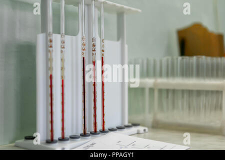 L'équipement de laboratoire pour l'analyse de sang. Le vrai travail de l'assistant de laboratoire à l'hôpital. Close-up. Banque D'Images