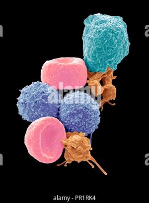 Les cellules sanguines. Couleur de l'analyse des électrons Microphotographie (SEM) des droits de globules rouges (érythrocytes, rouge), les globules blancs (leucocytes, bleu et cyan), et des plaquettes (thrombocytes, orange). Le, en forme de disque biconcave transport de l'oxygène dans les érythrocytes les cellules de l'organisme et éliminer le dioxyde de carbone dans les poumons. Les leucocytes sont partie du système immunitaire, la défense de l'organisme contre l'infection par des agents pathogènes par l'ingestion de la phagocytose ou en produisant des anticorps. Agrandissement : x5000 lors de l'impression 10 centimètres de haut. Banque D'Images