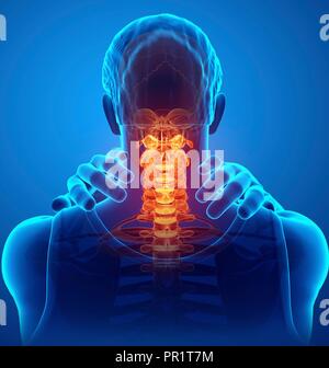 L'homme avec la douleur au cou, illustration de l'ordinateur. Banque D'Images