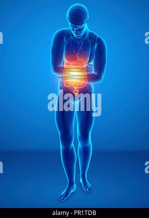 Homme avec douleur abdominale, illustration de l'ordinateur. Banque D'Images