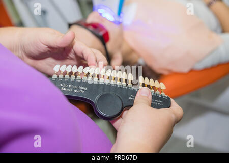 L'essai de blancheur dents d'un patient en bonne santé.Le blanchiment des dents. Concept de soins dentaires. Set d'implants avec différentes nuances de tons.dentiste dents correspondant au pouvoir de couleur Banque D'Images